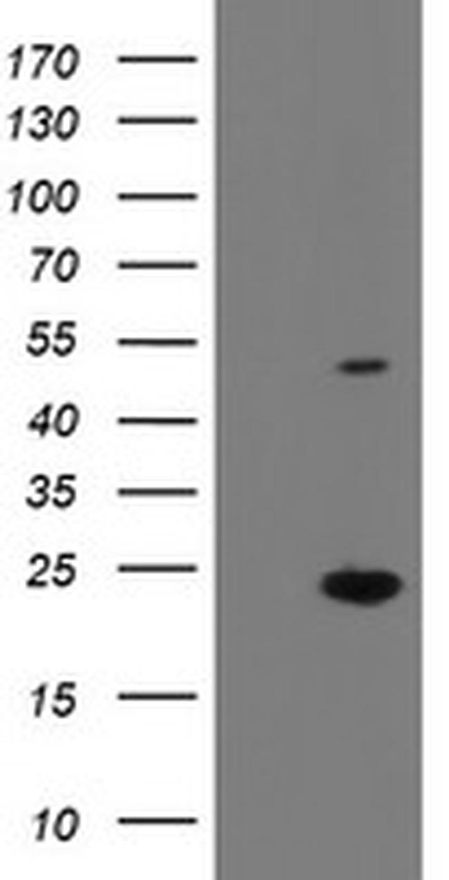 EIF5A2 Antibody in Western Blot (WB)