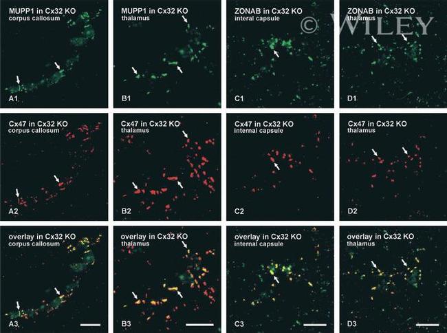 ZONAB Antibody in Immunohistochemistry (IHC)