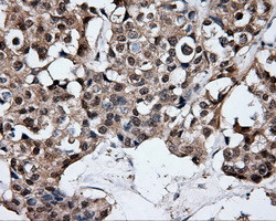 ELAVL1 Antibody in Immunohistochemistry (Paraffin) (IHC (P))