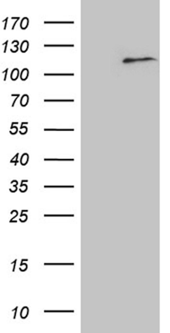 ELF4 Antibody in Western Blot (WB)