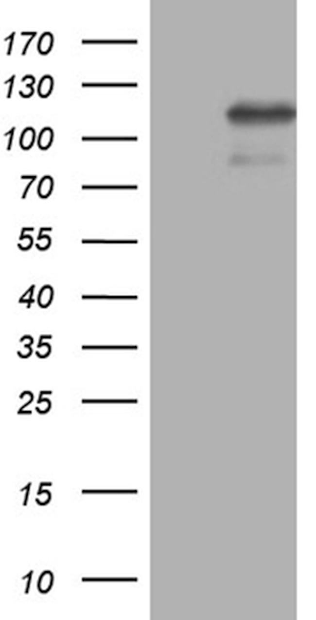 ELF4 Antibody in Western Blot (WB)