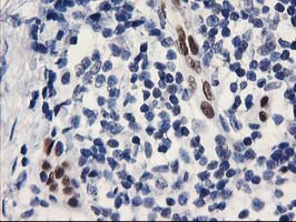 ELK3 Antibody in Immunohistochemistry (Paraffin) (IHC (P))