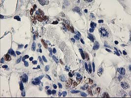 ELK3 Antibody in Immunohistochemistry (Paraffin) (IHC (P))