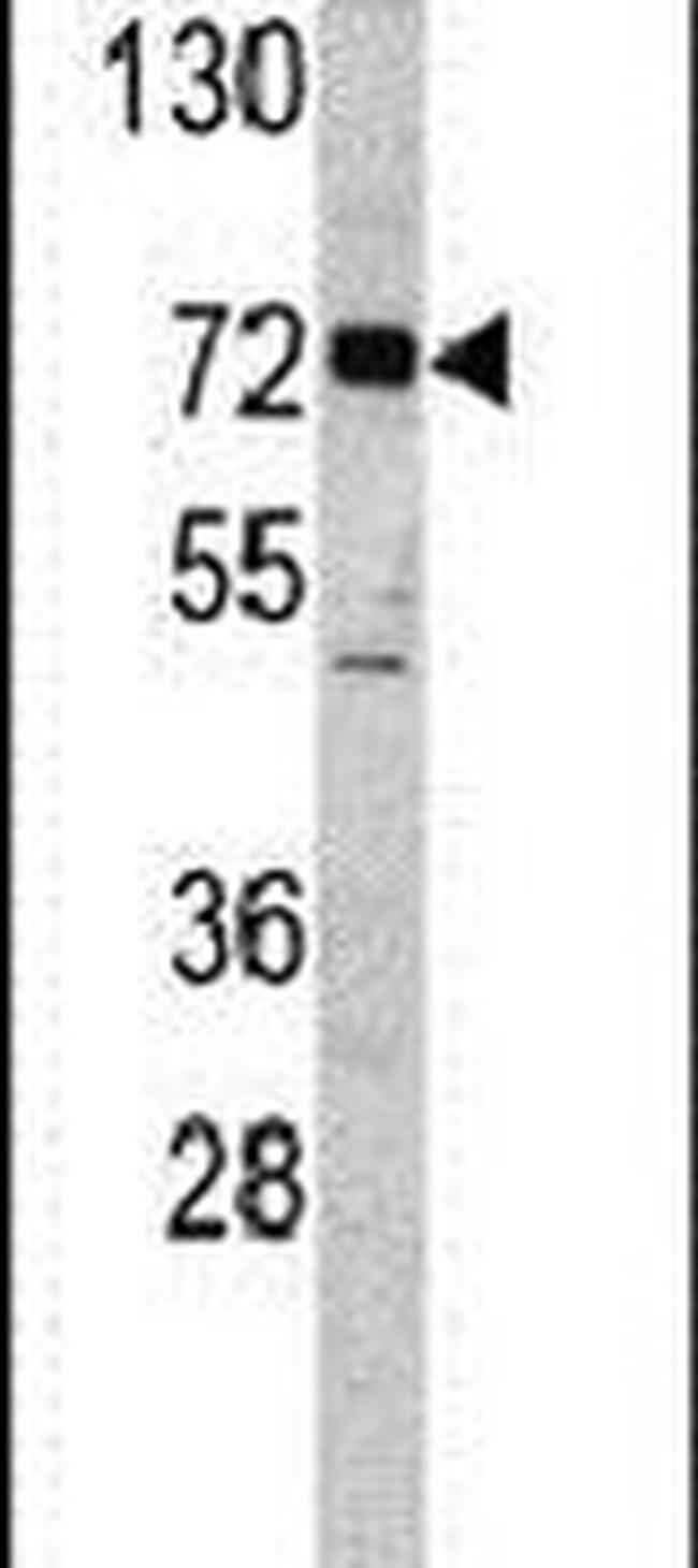 ELP2 Antibody in Western Blot (WB)