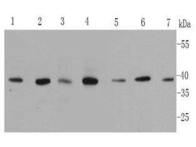 MAPK14 Antibody in Western Blot (WB)