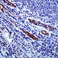 CD105 Antibody in Immunohistochemistry (IHC)