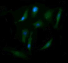 ENG Antibody in Immunocytochemistry (ICC/IF)