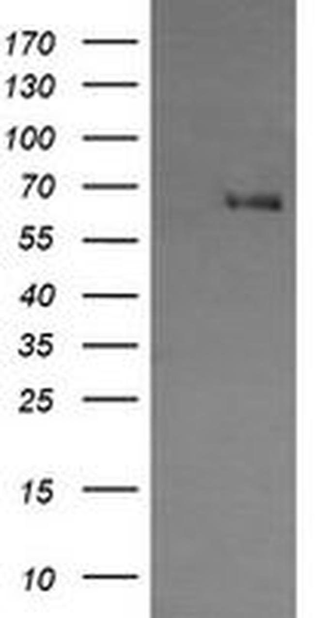 ENG Antibody in Western Blot (WB)