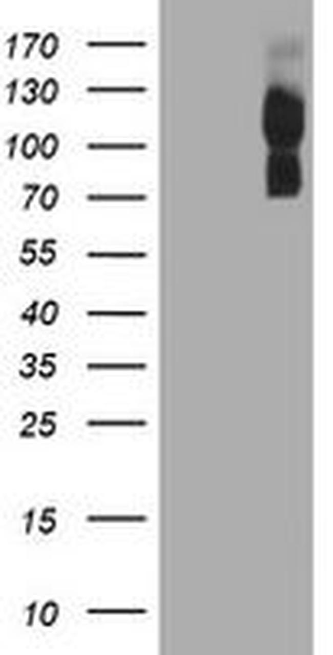 ENPEP Antibody in Western Blot (WB)