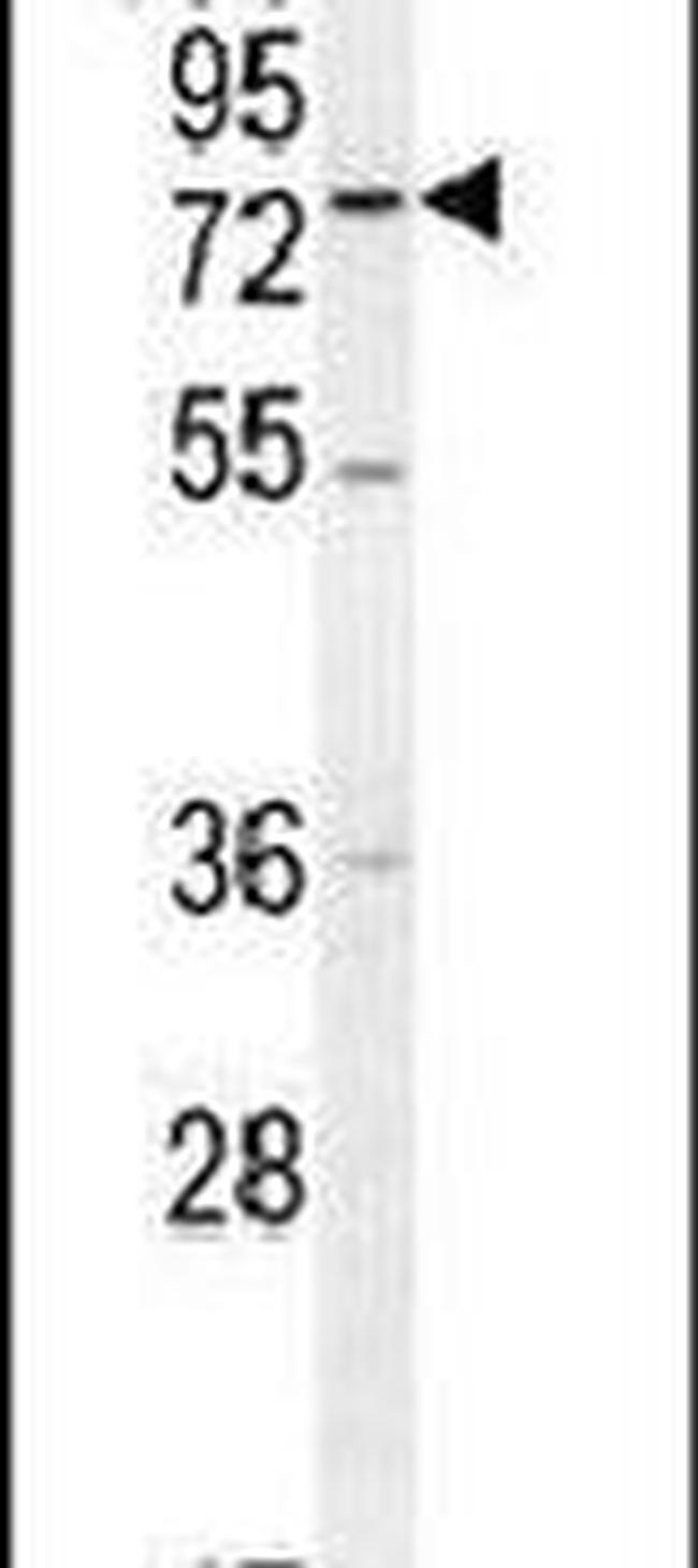 ENTHD1 Antibody in Western Blot (WB)