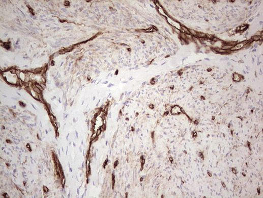 ENTPD1 Antibody in Immunohistochemistry (Paraffin) (IHC (P))