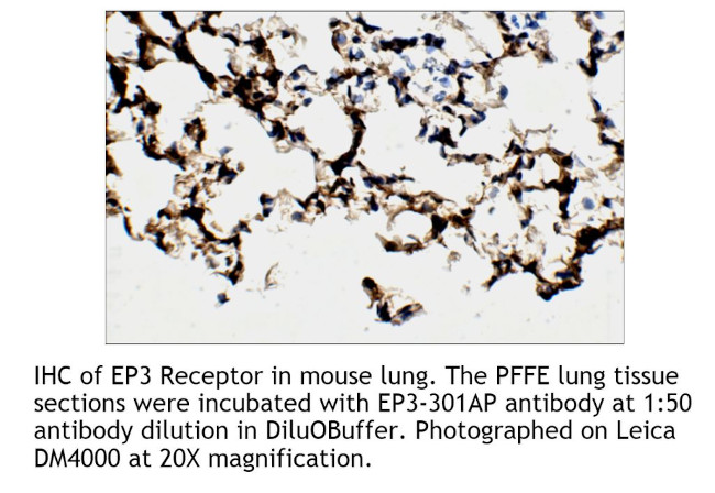 PTGER3 Antibody in Immunohistochemistry (IHC)