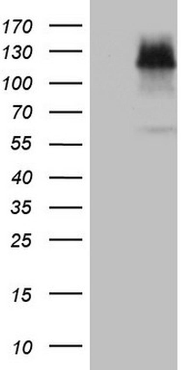 EPAS1 Antibody in Western Blot (WB)