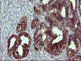 EPCAM Antibody in Immunohistochemistry (Paraffin) (IHC (P))