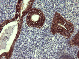 EPCAM Antibody in Immunohistochemistry (Paraffin) (IHC (P))