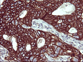 EPCAM Antibody in Immunohistochemistry (Paraffin) (IHC (P))