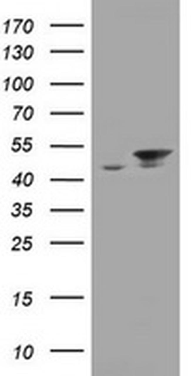 EPHX1 Antibody in Western Blot (WB)