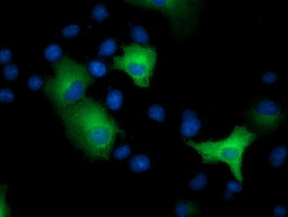 EPHX2 Antibody in Immunocytochemistry (ICC/IF)