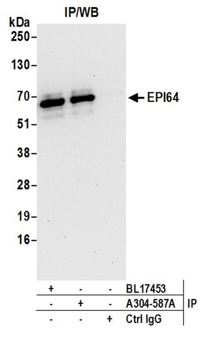 EPI64 Antibody in Western Blot (WB)