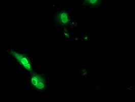 EPM2AIP1 Antibody in Immunocytochemistry (ICC/IF)