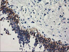 EPM2AIP1 Antibody in Immunohistochemistry (Paraffin) (IHC (P))