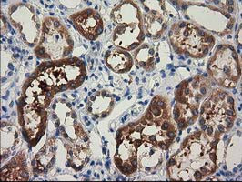 EPM2AIP1 Antibody in Immunohistochemistry (Paraffin) (IHC (P))