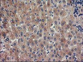 EPM2AIP1 Antibody in Immunohistochemistry (Paraffin) (IHC (P))