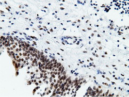 EPM2AIP1 Antibody in Immunohistochemistry (Paraffin) (IHC (P))