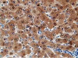 EPM2AIP1 Antibody in Immunohistochemistry (Paraffin) (IHC (P))