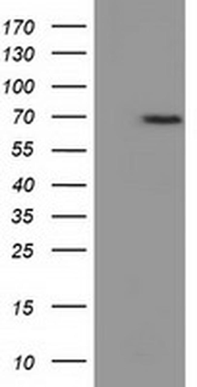 EPM2AIP1 Antibody in Western Blot (WB)