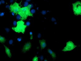 EPN2 Antibody in Immunocytochemistry (ICC/IF)