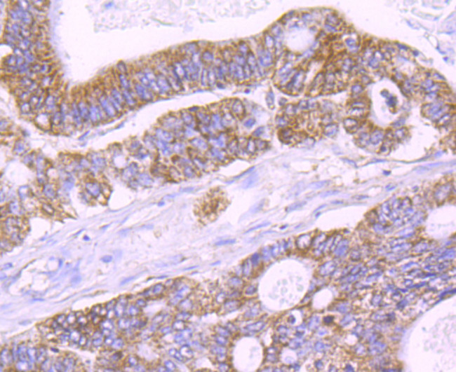 IL-1 alpha Antibody in Immunohistochemistry (Paraffin) (IHC (P))