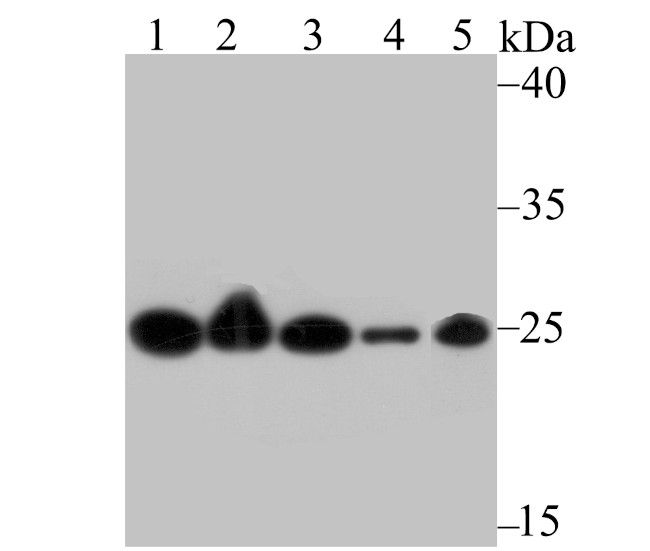GST3 Antibody in Western Blot (WB)