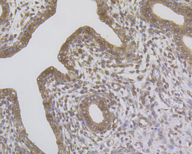 ERN1 Antibody in Immunohistochemistry (Paraffin) (IHC (P))