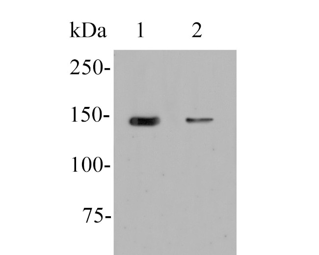 ERN1 Antibody in Western Blot (WB)