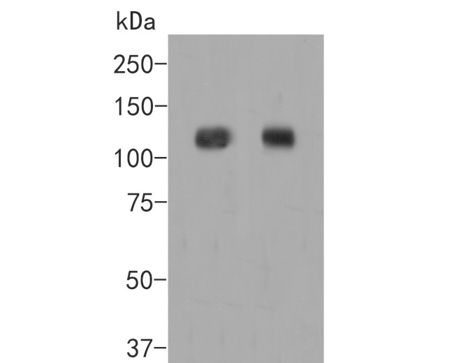 EPHA2 Antibody in Western Blot (WB)