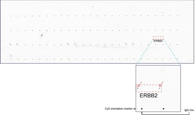 ERBB2 Antibody in Peptide array (ARRAY)