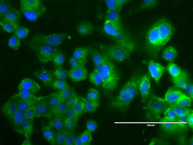 ERBB2 Antibody in Immunocytochemistry (ICC/IF)