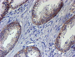 ERBB2 Antibody in Immunohistochemistry (Paraffin) (IHC (P))