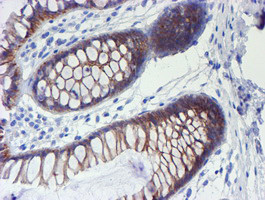 ERBB2 Antibody in Immunohistochemistry (Paraffin) (IHC (P))