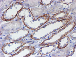 ERBB2 Antibody in Immunohistochemistry (Paraffin) (IHC (P))