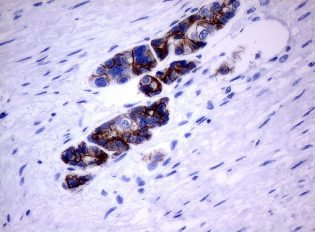 ERBB2 Antibody in Immunohistochemistry (Paraffin) (IHC (P))