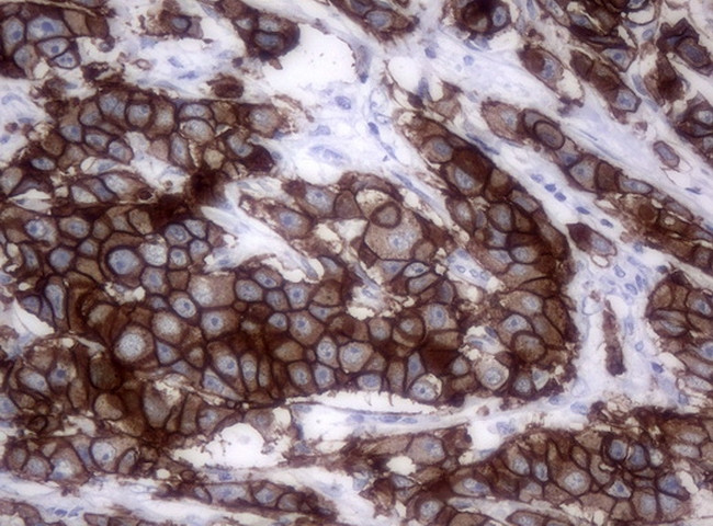 ERBB2 Antibody in Immunohistochemistry (Paraffin) (IHC (P))