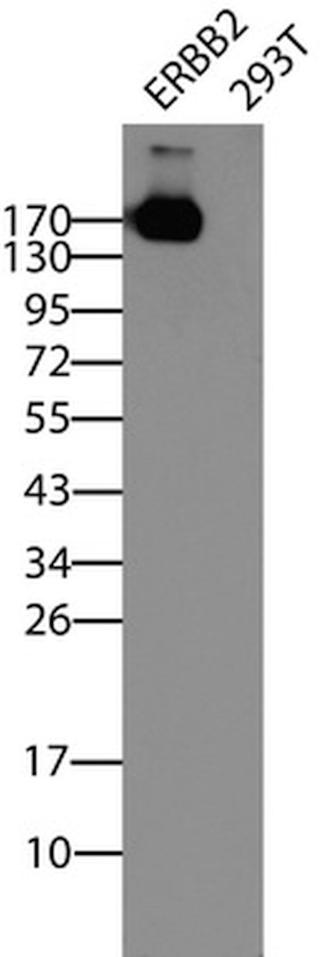 ERBB2 Antibody in Western Blot (WB)