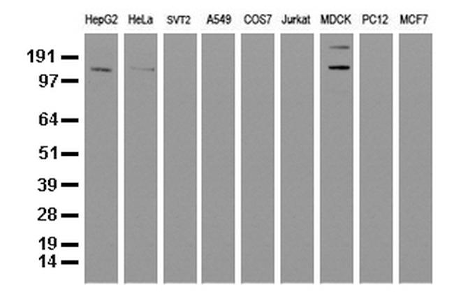 ERBB2 Antibody in Western Blot (WB)