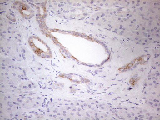 ERBB3 Antibody in Immunohistochemistry (Paraffin) (IHC (P))