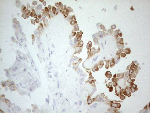 ERBB3 Antibody in Immunohistochemistry (Paraffin) (IHC (P))