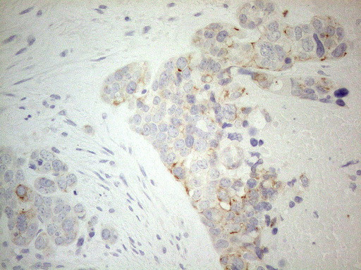 ERBB3 Antibody in Immunohistochemistry (Paraffin) (IHC (P))