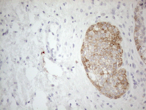 ERBB3 Antibody in Immunohistochemistry (Paraffin) (IHC (P))