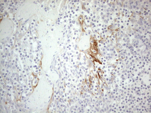 ERBB3 Antibody in Immunohistochemistry (Paraffin) (IHC (P))